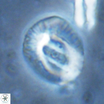 Helicosphaera lophota VR 02838