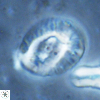 Helicosphaera lophota VR 02839