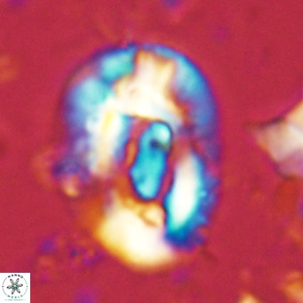 Helicosphaera lophota VR 02373