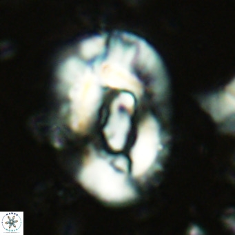 Helicosphaera lophota VR 02374