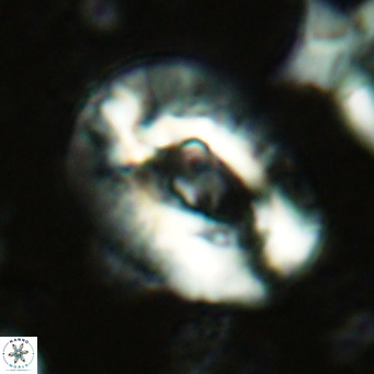 Helicosphaera lophota VR 02375