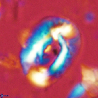 Helicosphaera lophota VR 02377