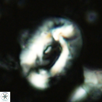 Helicosphaera lophota VR 02378