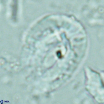 Helicosphaera lophota VR 02379