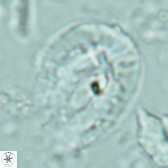 Helicosphaera lophota VR 02379