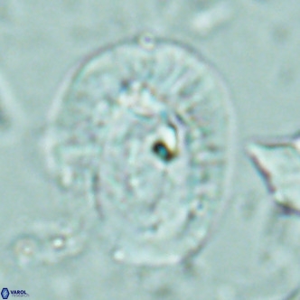 Helicosphaera lophota VR 02380