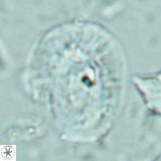 Helicosphaera lophota VR 02380