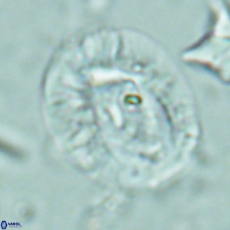 Helicosphaera lophota VR 02381