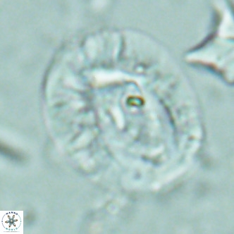 Helicosphaera lophota VR 02381