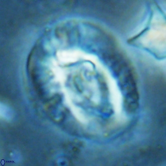 Helicosphaera lophota VR 02382