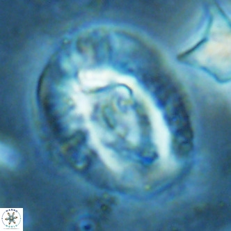 Helicosphaera lophota VR 02382