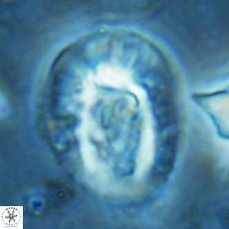 Helicosphaera lophota VR 02383