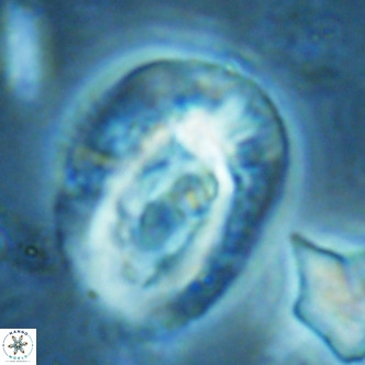 Helicosphaera lophota VR 02384