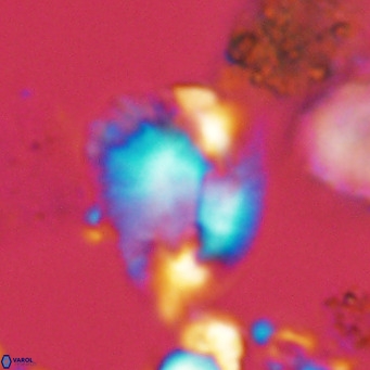 Helicosphaera pteryga VR 05860