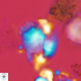 Helicosphaera pteryga VR 05860