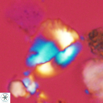 Helicosphaera pteryga VR 05863
