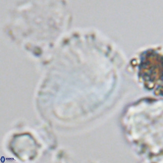 Helicosphaera pteryga VR 05864