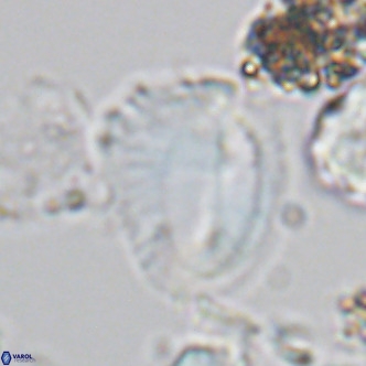 Helicosphaera pteryga VR 05865