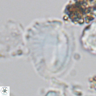 Helicosphaera pteryga VR 05865