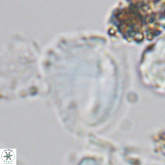 Helicosphaera pteryga VR 05870