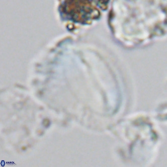 Helicosphaera pteryga VR 05868