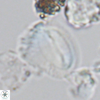 Helicosphaera pteryga VR 05868