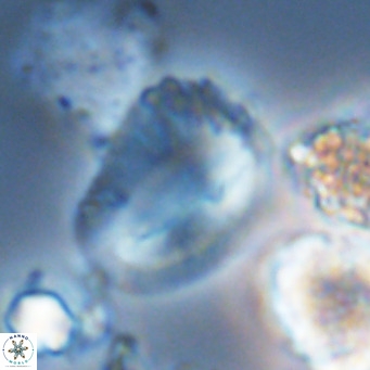 Helicosphaera pteryga VR 05871