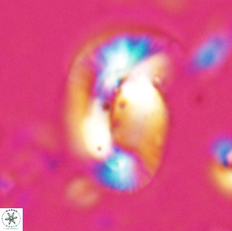 Helicosphaera paleocarteri 26530