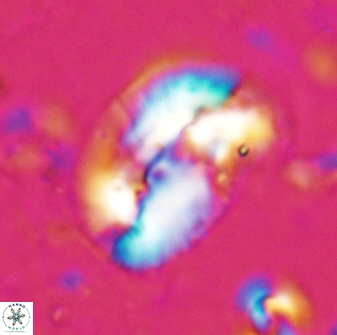 Helicosphaera paleocarteri 26531