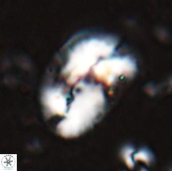 Helicosphaera paleocarteri 26532