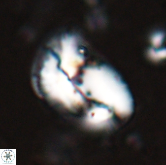 Helicosphaera paleocarteri 26533