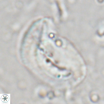 Helicosphaera paleocarteri 26535