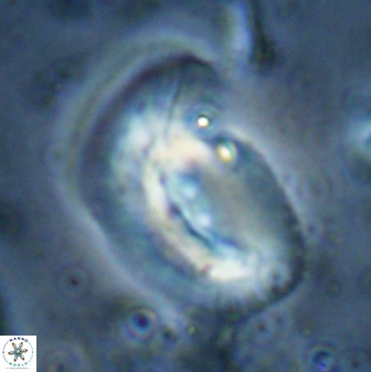 Helicosphaera paleocarteri 26538