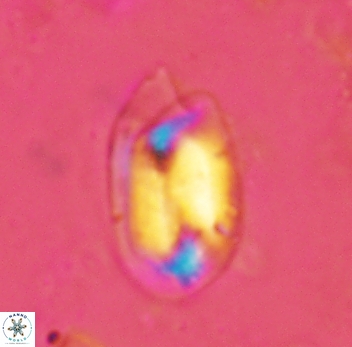 Helicosphaera perch-nielseniae 2351