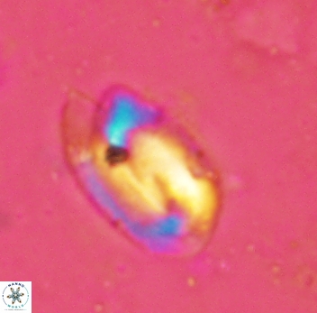 Helicosphaera perch-nielseniae 2353