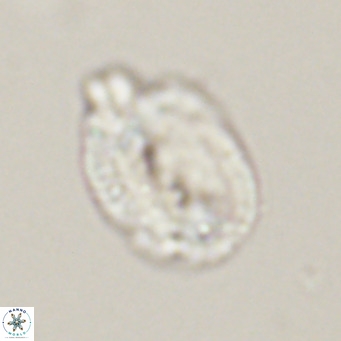 Helicosphaera perch nielseniae VR 34108