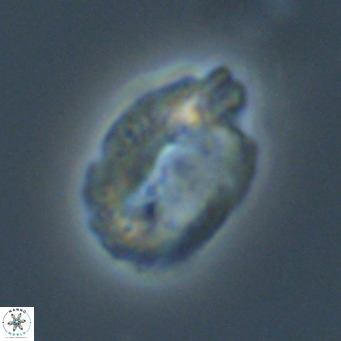 Helicosphaera perch nielseniae VR 34111