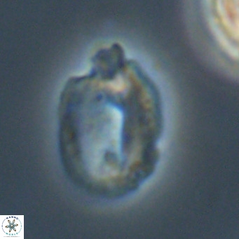 Helicosphaera perch nielseniae VR 34113