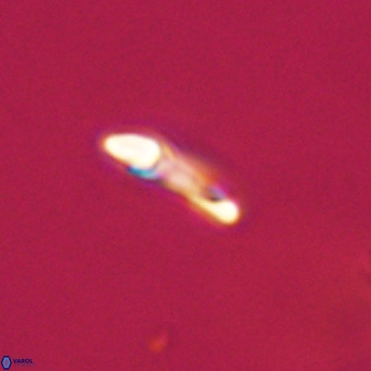 Helicosphaera philippinensis VR 22002