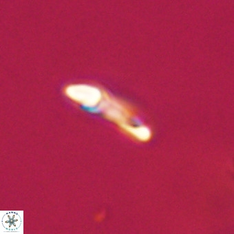 Helicosphaera philippinensis VR 22002