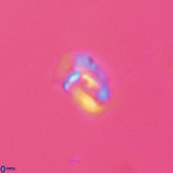 Helicosphaera philippinensis VR 22014