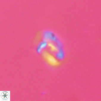 Helicosphaera philippinensis VR 22014