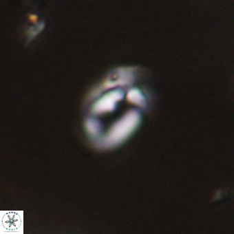 Helicosphaera philippinensis VR 22018