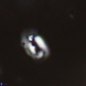 Helicosphaera philippinensis VR 22021