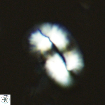 Helicosphaera princei VR 03625