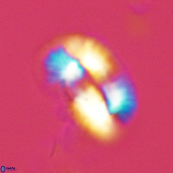 Helicosphaera princei VR 03626