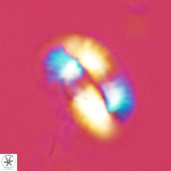 Helicosphaera princei VR 03626