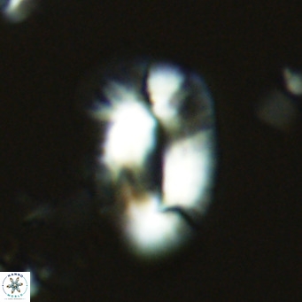Helicosphaera princei VR 03627