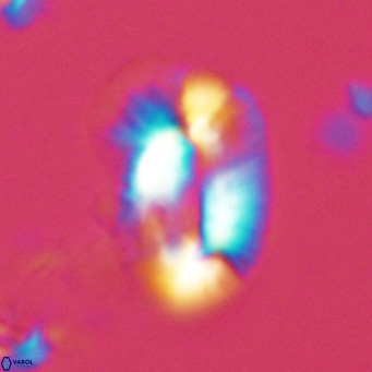 Helicosphaera princei VR 03628