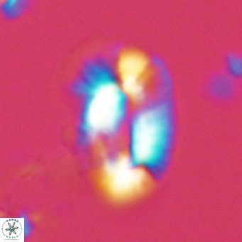 Helicosphaera princei VR 03628